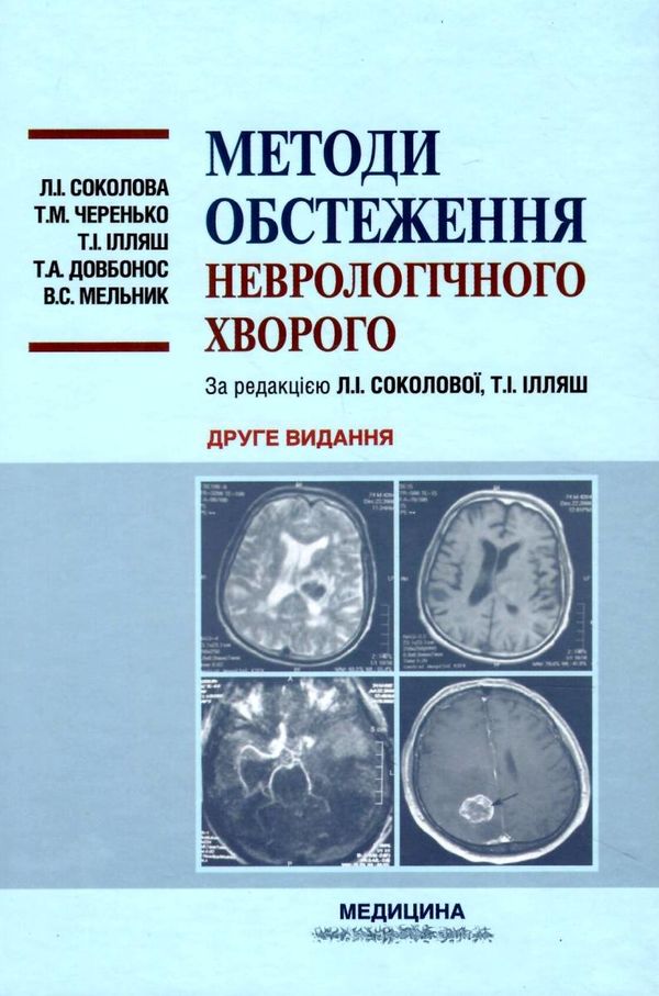 методи обстеження неврологічного хворого навчальний посібник для студентів Медицина Ціна (цена) 285.40грн. | придбати  купити (купить) методи обстеження неврологічного хворого навчальний посібник для студентів Медицина доставка по Украине, купить книгу, детские игрушки, компакт диски 1