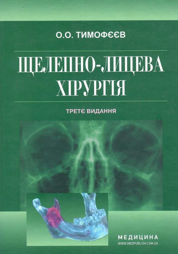 щелепно-лицева хірургія тимофєєв підручник 3-тє видання книга медицина Ціна (цена) 954.50грн. | придбати  купити (купить) щелепно-лицева хірургія тимофєєв підручник 3-тє видання книга медицина доставка по Украине, купить книгу, детские игрушки, компакт диски 0