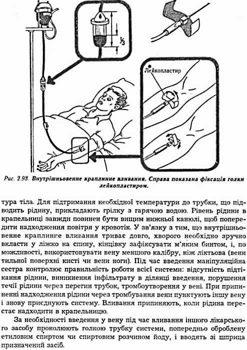 основи сестринської справи підручник    Укрмедкнига Ціна (цена) 159.80грн. | придбати  купити (купить) основи сестринської справи підручник    Укрмедкнига доставка по Украине, купить книгу, детские игрушки, компакт диски 6