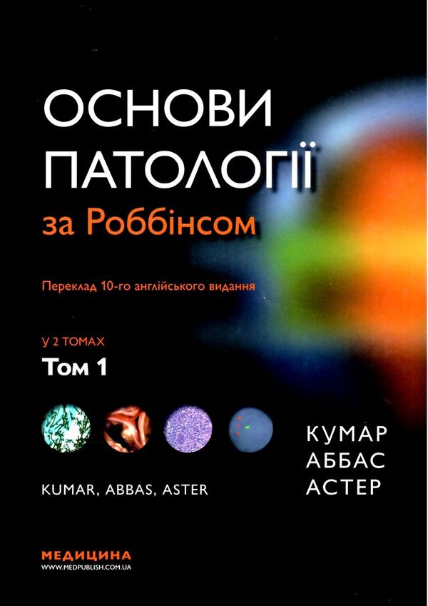 основи патології за роббінсом у 2х томах том 1 книга    Медицина Ціна (цена) 705.30грн. | придбати  купити (купить) основи патології за роббінсом у 2х томах том 1 книга    Медицина доставка по Украине, купить книгу, детские игрушки, компакт диски 1